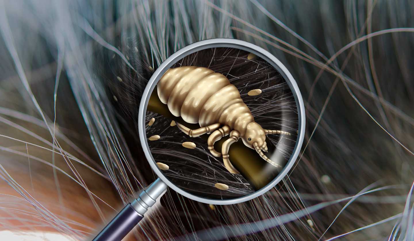 Pediculosis Capitis Life Cycle 