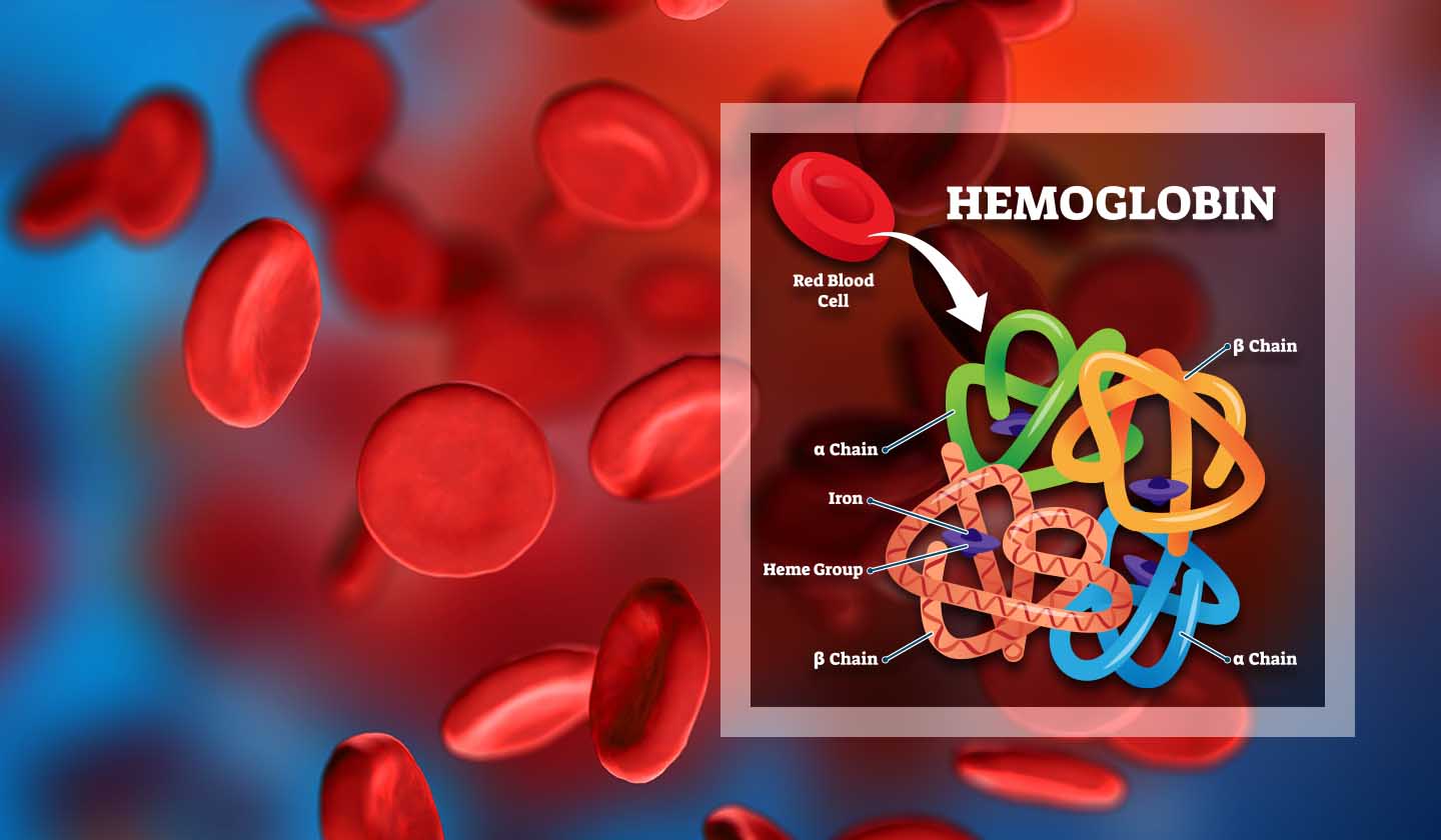 What is iron deficiency anaemia