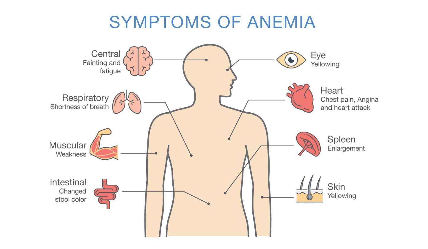 Iron deficiency anaemia signals
