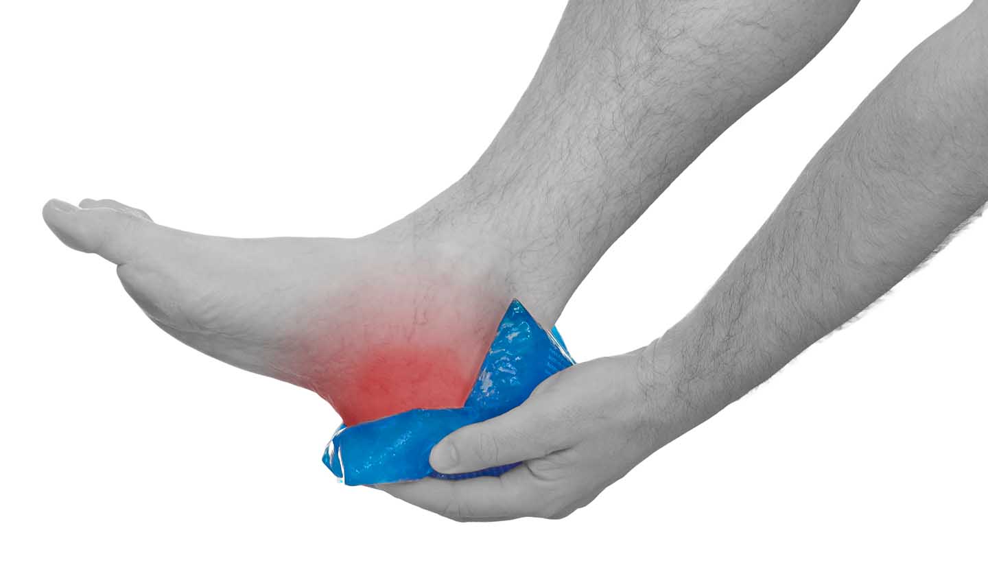 Treatment of heel spurs