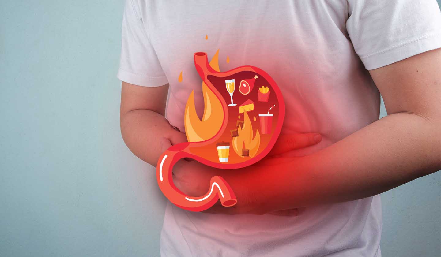 Foods that worsen gastroesophageal reflux