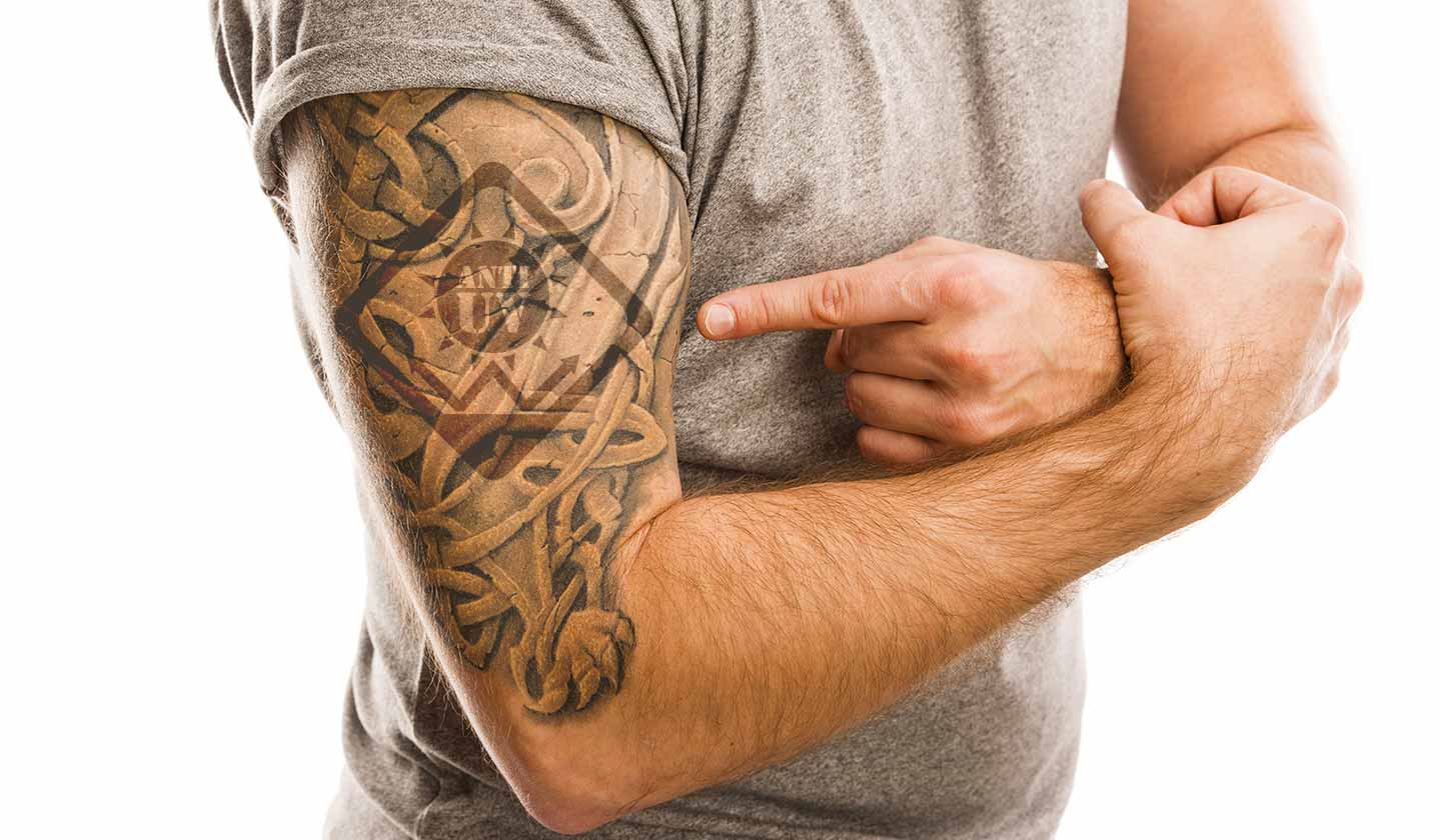 7 SKIN REACTIONS TO TATTOOS  SPRINGS Dermatology MD