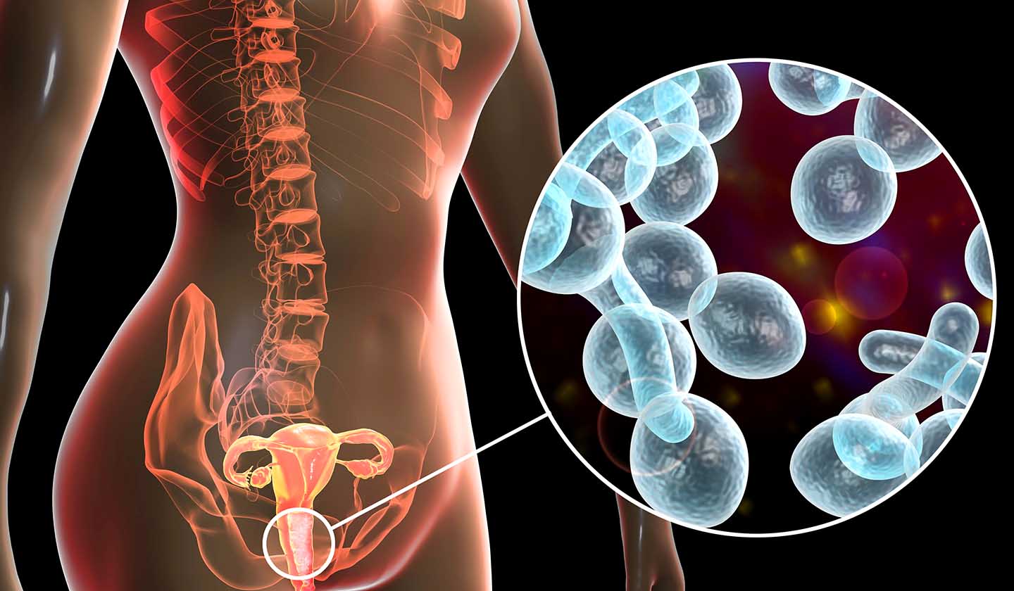 Fungus responsible for vaginal candidiasis