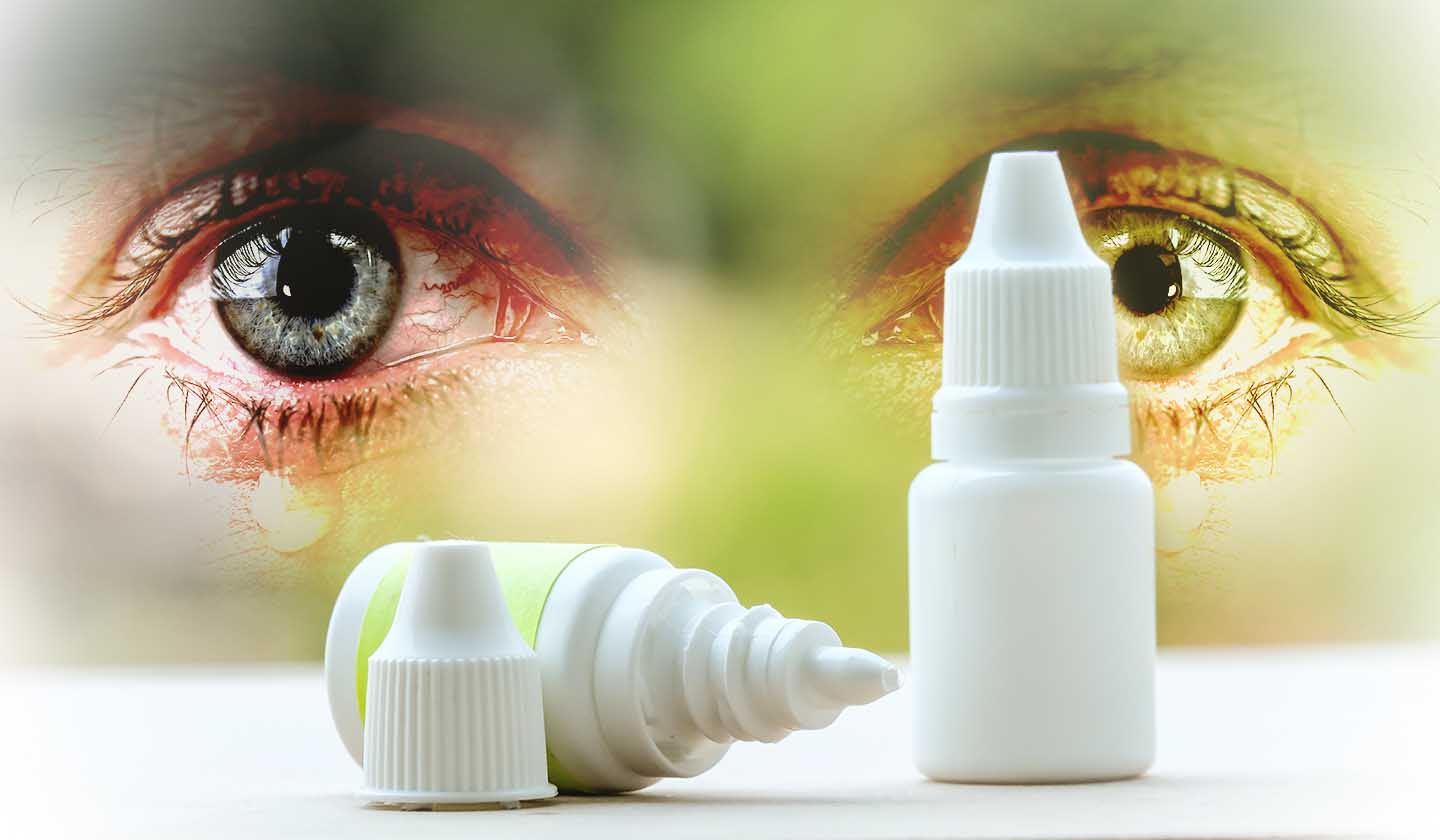 Topical products help to treat conjunctivitis