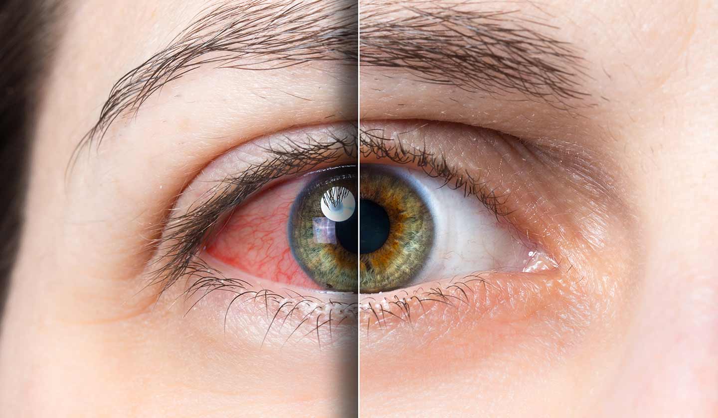 Habits that harm the health of our eyes