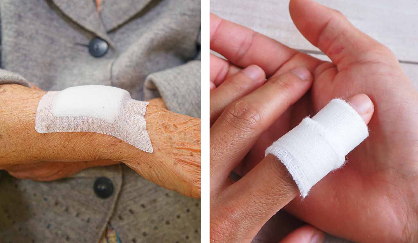 Wounds and Scratches - How to treat it