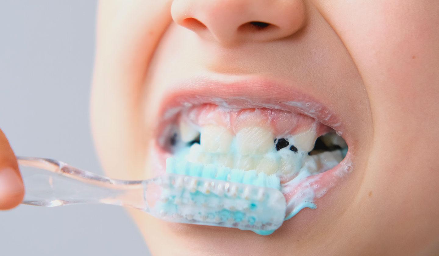 A importância da higiene oral na infância