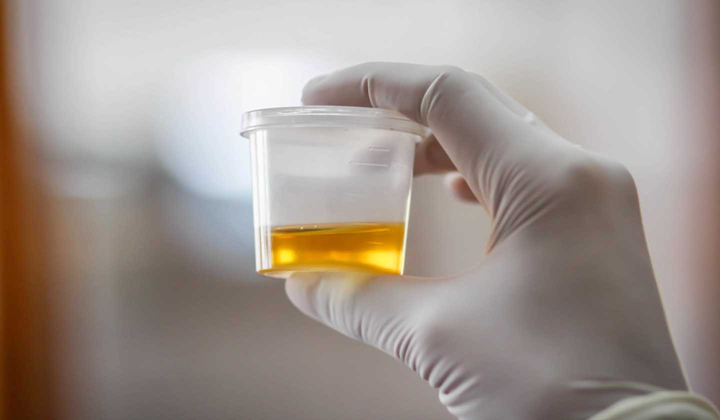 Teste rápido de urina