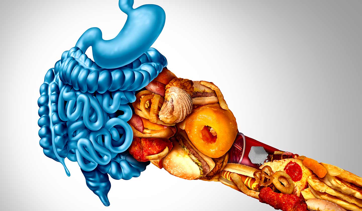 Main causes of obesity