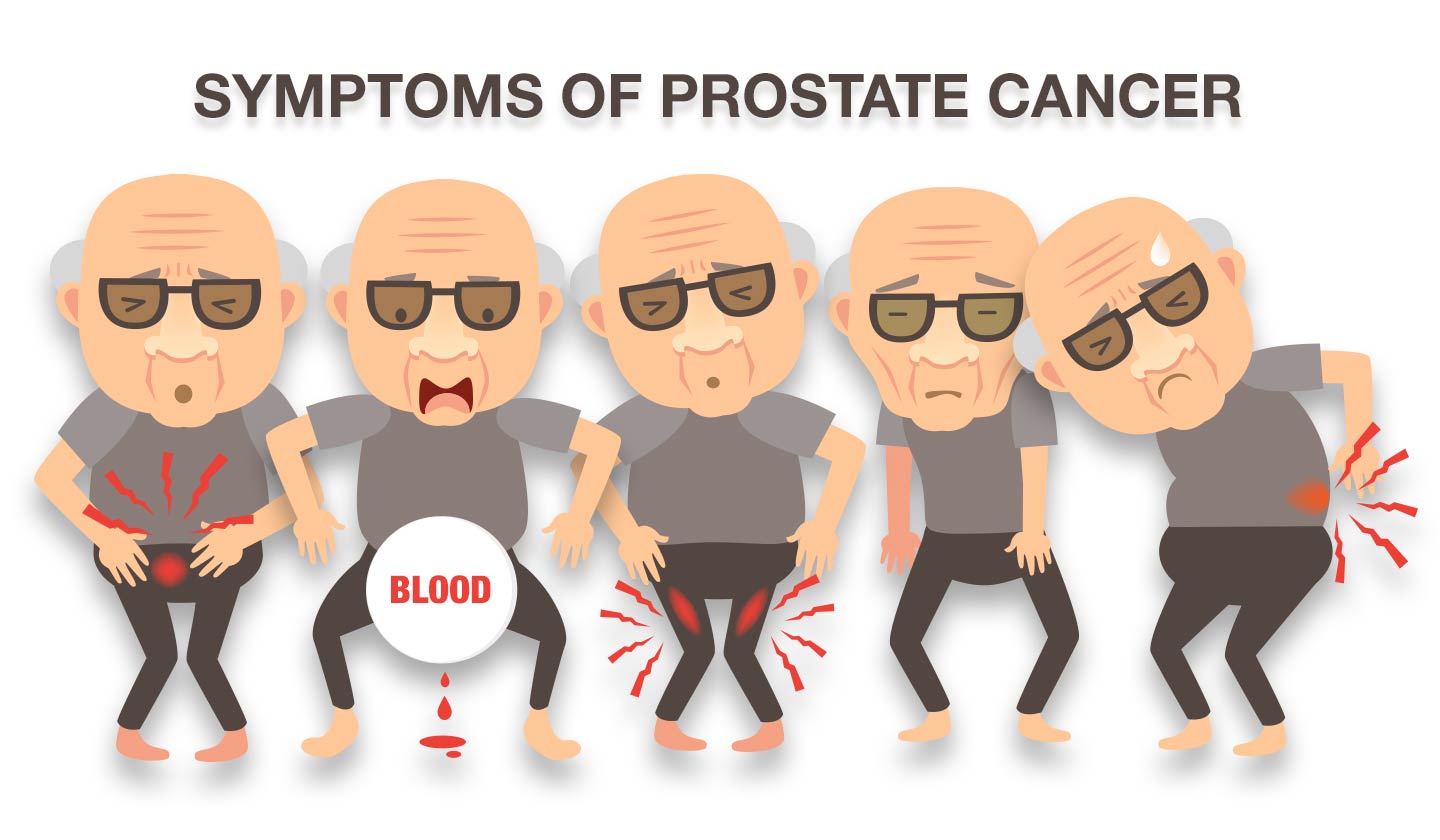 Prostate Cancer