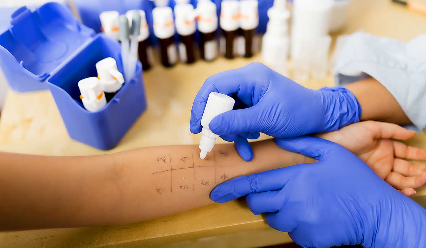 Skin tests to identify allergens