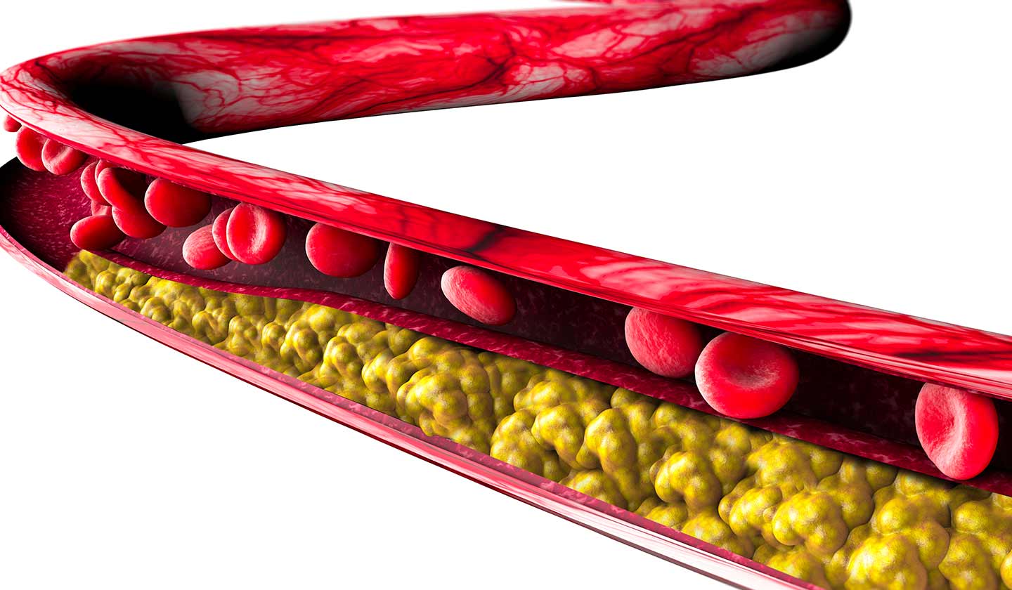 Cholesterol